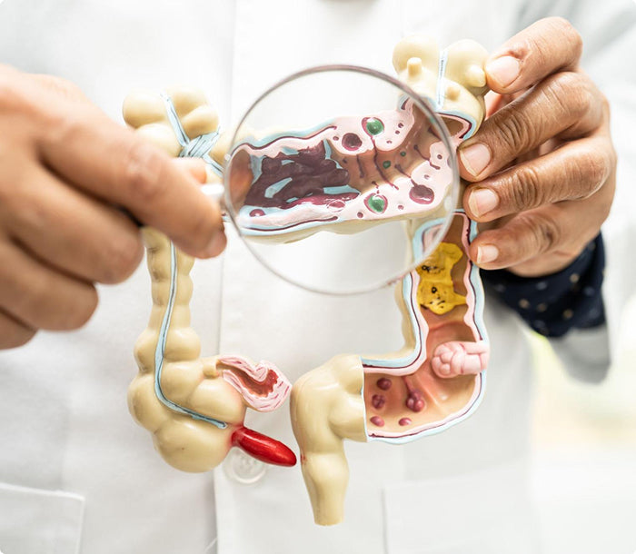 Antioxidants_and_gut_health