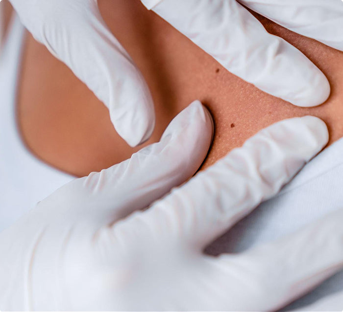 Calming_inflammation